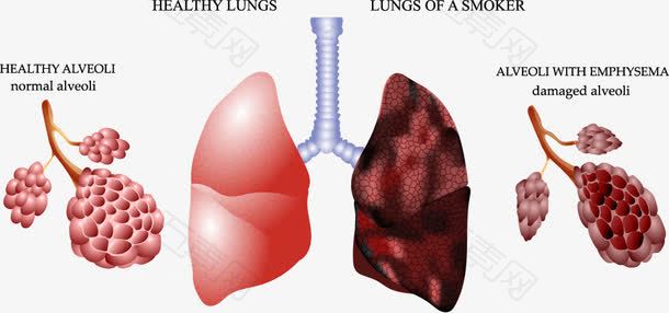 健康肺和香烟污染的肺对比图